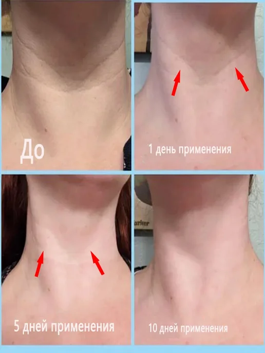 Антивозрастная маска для шеи, против морщин, 10 штук, 10 шт, фото 3