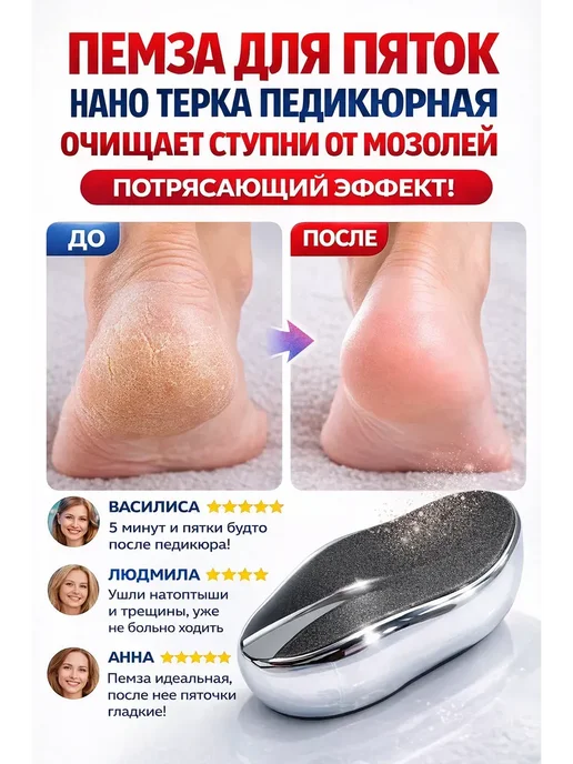Rozzak пемзы для ног нано терка от мозолей и натоптышей профессиона…, вариант