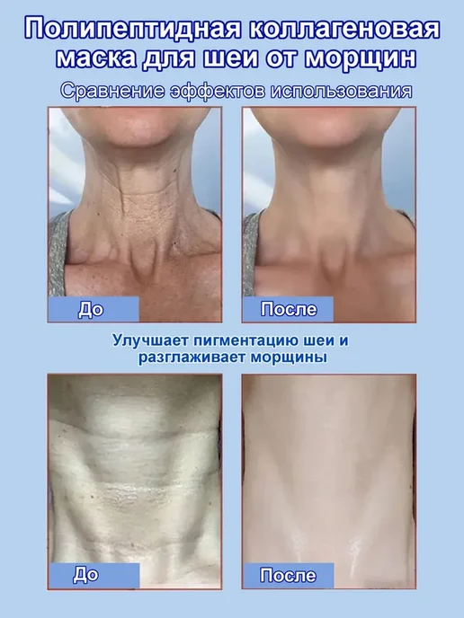 Патчи для шеи антивозрастные против морщин, лифтинг, 10 шт, 10 шт, фото 4