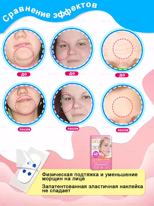 Корректирующие патчи для похудения и подтяжки лица, 40 шт, фото 3