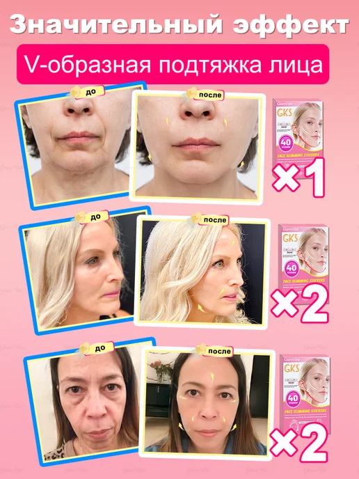 Корректирующие патчи для похудения и подтяжки лица, 40 шт, фото 4