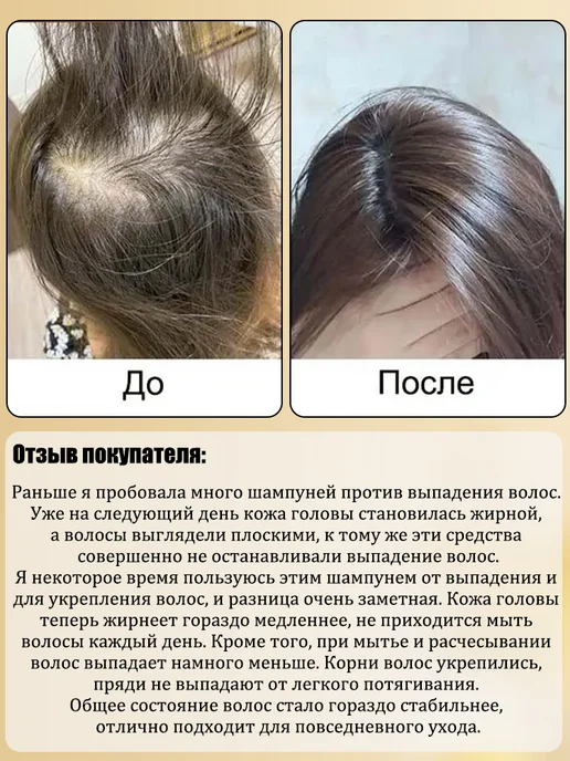 LYDIMOON Имбирный шампунь для роста волос и от выпадения, 300 мл, 300 мл, фото 6