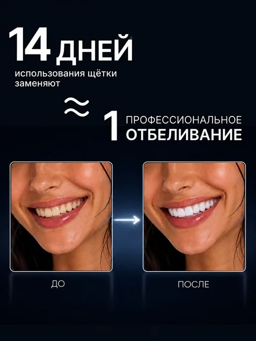 Xiaomi Ультразвуковая зубная щетка электрическая LED отбеливающая, белый, фото 2