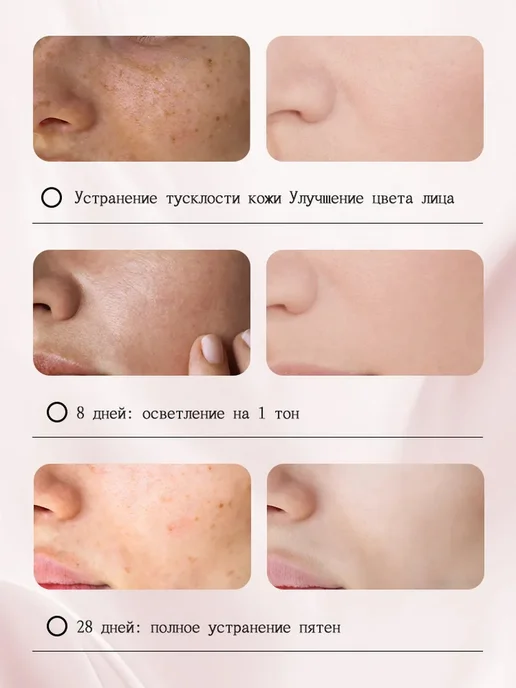 Отбеливающий пластырь от пигментных пятен для лица, вариант, фото 2