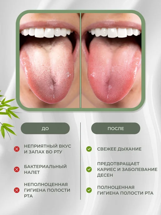 Скребок для языка, зеленый, зеленый, фото 2