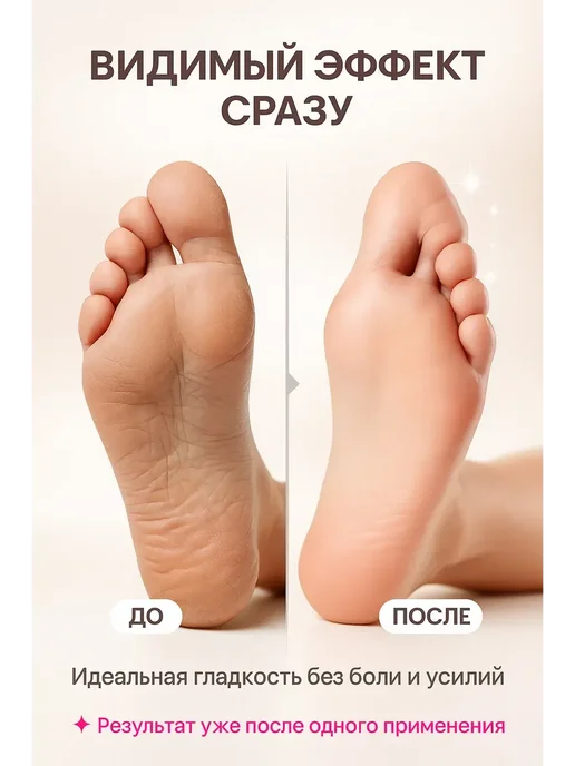 ДК81 Электрическая пилка для ног с роликом, вариант, фото 6