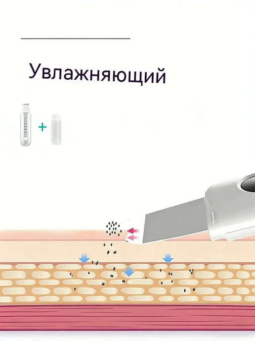 Ультразвуковая чистка лица аппарат уз от черных точек прыщей, черный, фото 6