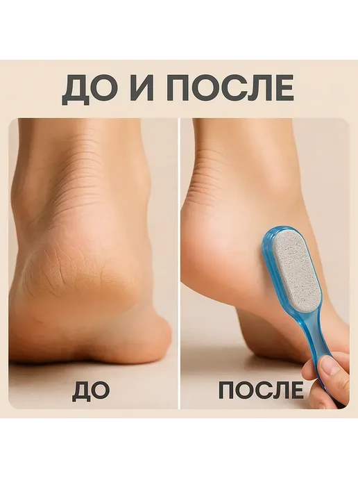 Q Щетка для ног с пемзой для ухода и очищения, синий, фото 2