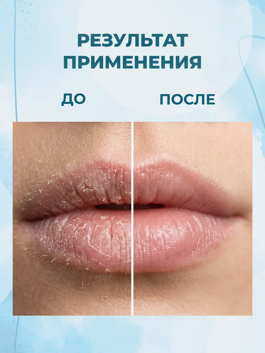 Himalaya Since 1930 Бальзам для губ питательный с маслом ростков пшеницы 10 г, 10 г, фото 2