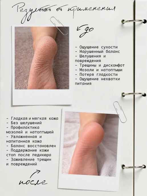Увлажняющий крем баттер для рук, ног, тела для сухой и очень, вариант, фото 3