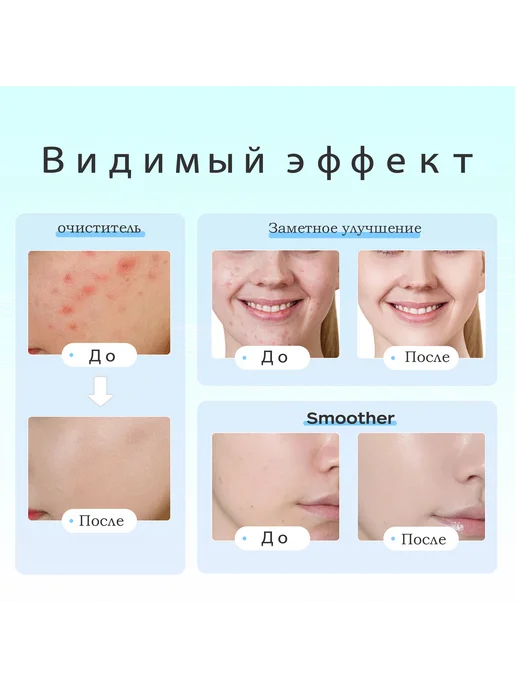 LED маска для лица Фототерапия, вариант, фото 5