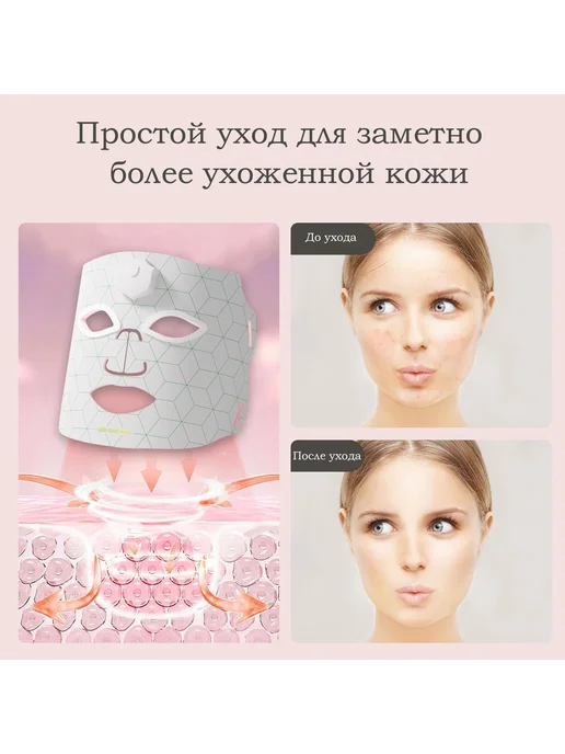 LED маска для лица, вариант, фото 3
