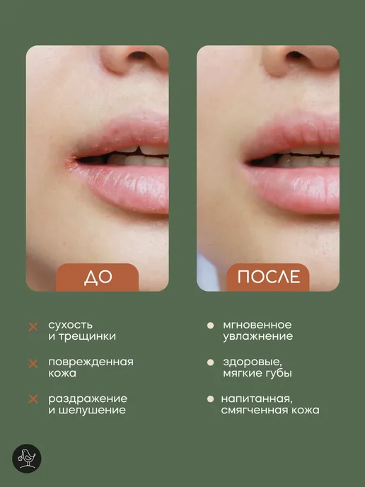 КРАСНОПОЛЯНСКАЯ КОСМЕТИКА Набор гидролат Апельсин 100 мл, Бальзам для губ Ваниль 5 мл, 100 мл, 5 мл, фото 8