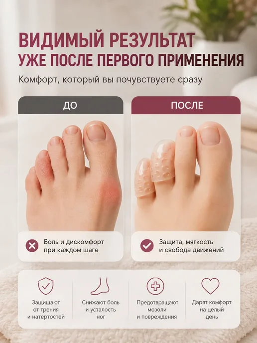 Далиль Защитные силиконовые напальчники для пальцев ног от мозолей, 5 шт, фото 3
