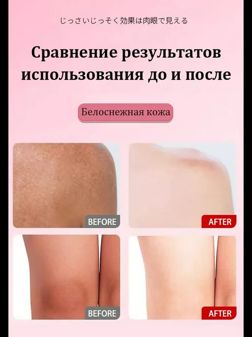 Ниацинамидное отбеливающее мыло для тела и лица, Увлажняющее, вариант, фото 6
