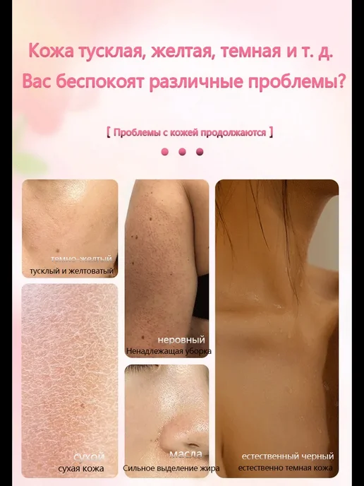 Ниацинамидное отбеливающее мыло для тела и лица, Увлажняющее, вариант, фото 8