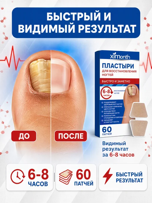XIMonth Пластырь от грибка для коррекции вросших ногтей, 60 шт, фото 2
