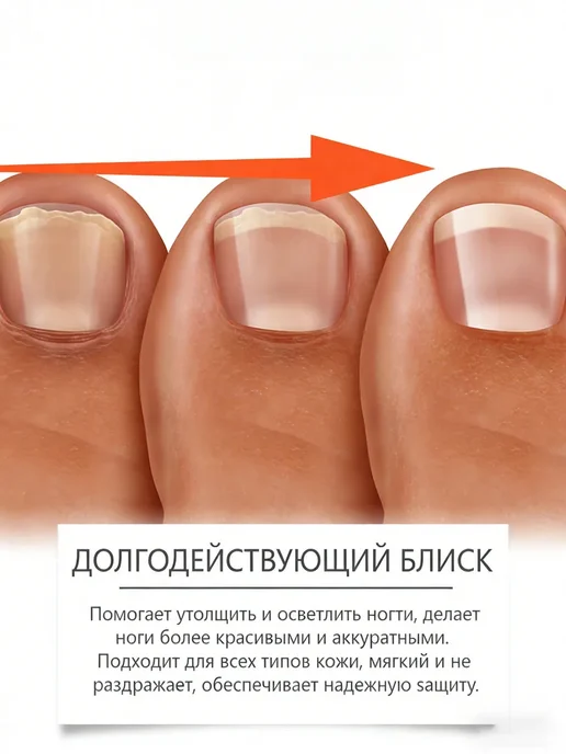 XIMonth Пластырь от грибка для коррекции вросших ногтей, 60 шт, фото 7