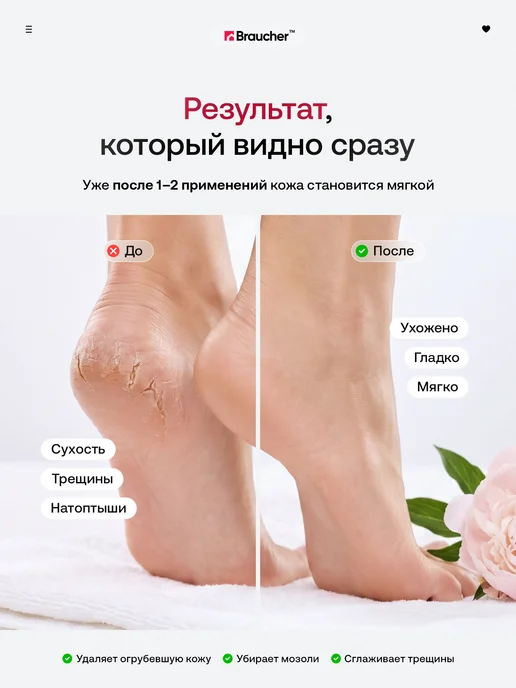 Braucher Беспроводной аппарат для педикюра пяток профессиональный, белый, фото 2