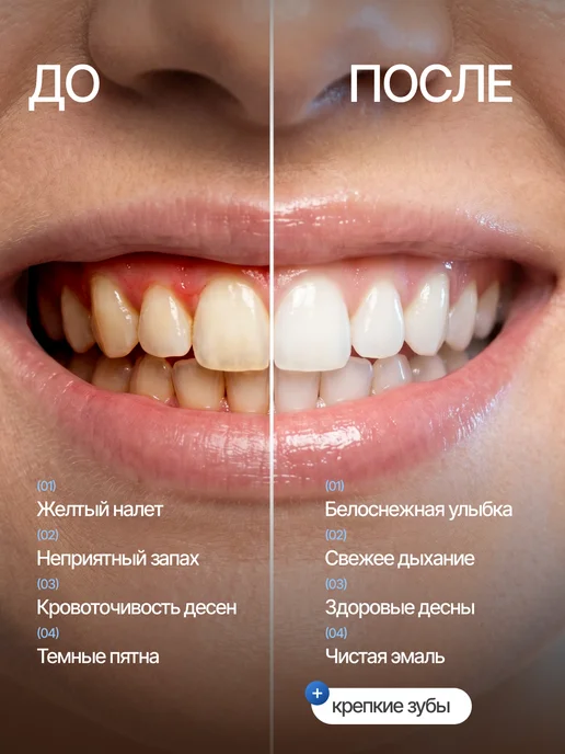 Korealiss отбеливающая зубная паста для чувствительных зубов 3 шт, 3 шт, фото 6