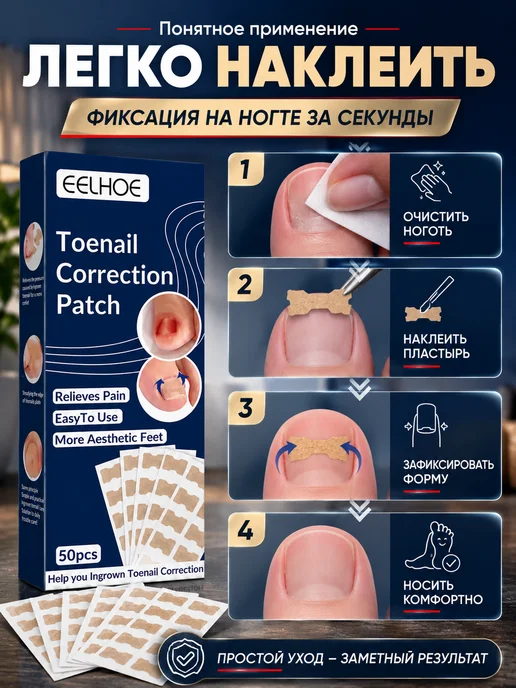 АйНУРУ Средство для коррекции вросшего ногтя, бежевый, фото 4
