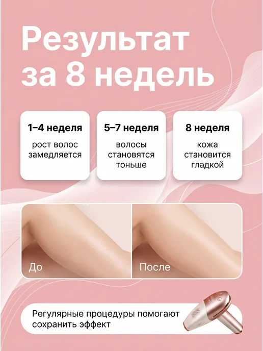 Лазерный фотоэпилятор профессиональный для удаления волос, розовый, фото 6