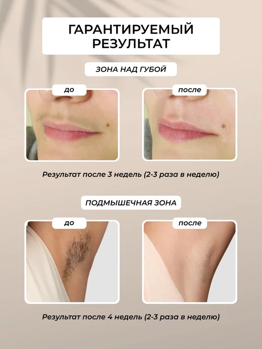 Doctor Comfort Фотоэпилятор лазерный CL-2 Comfort IPL, белый, фото 3