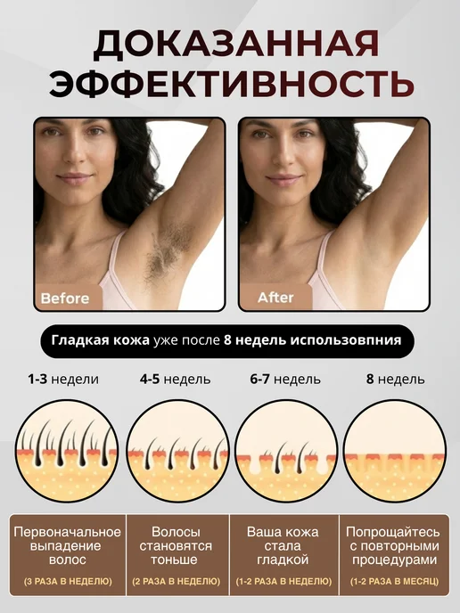 Лазерный фотоэпилятор IPL с охлаждением для депиляции, вариант, фото 2