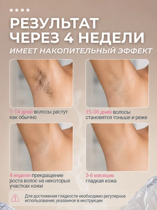 Annaligh Фотоэпилятор лазерный профессиональный для удаления волос, белый, фото 7