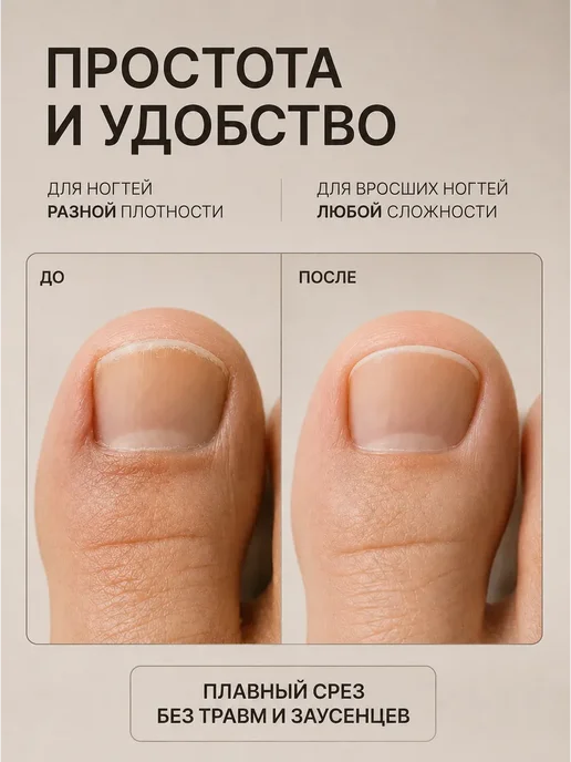 Xiaomi Кусачки для ногтей маникюрные и педикюрные, черный, фото 5