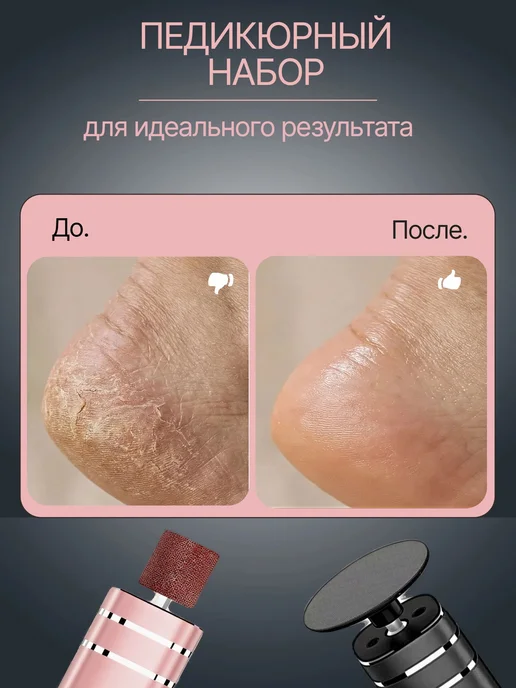 LIVIL Аппарат для педикюра электрическая пилка для пяток ног, розовый, фото 7