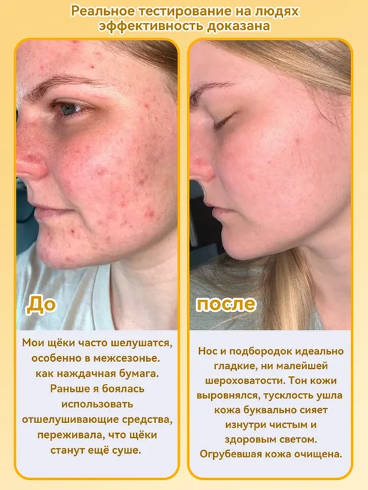 Отшелушивающий скраб для лица очищающий отбеливающий, вариант, фото 5