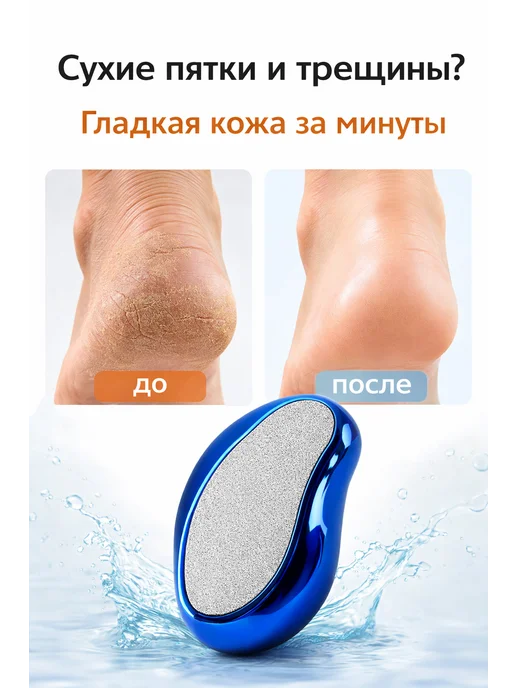 Пилка для пяток терка для ног от мозолей, синий, фото 2