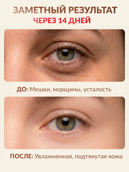 Whatever Массажер для глаз микротоковый, белый, фото 5