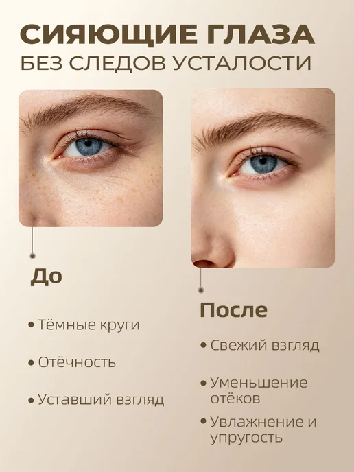 Кофеин + ниацинамид маска для глаз подтягивающая, 60 шт, 60 шт, фото 2