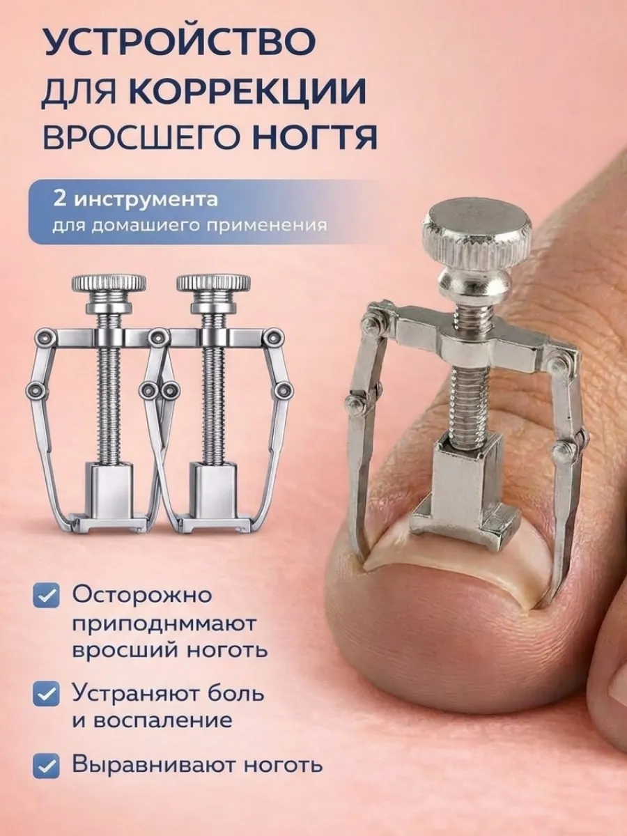 Корректор для вросшего ногтя на ногах