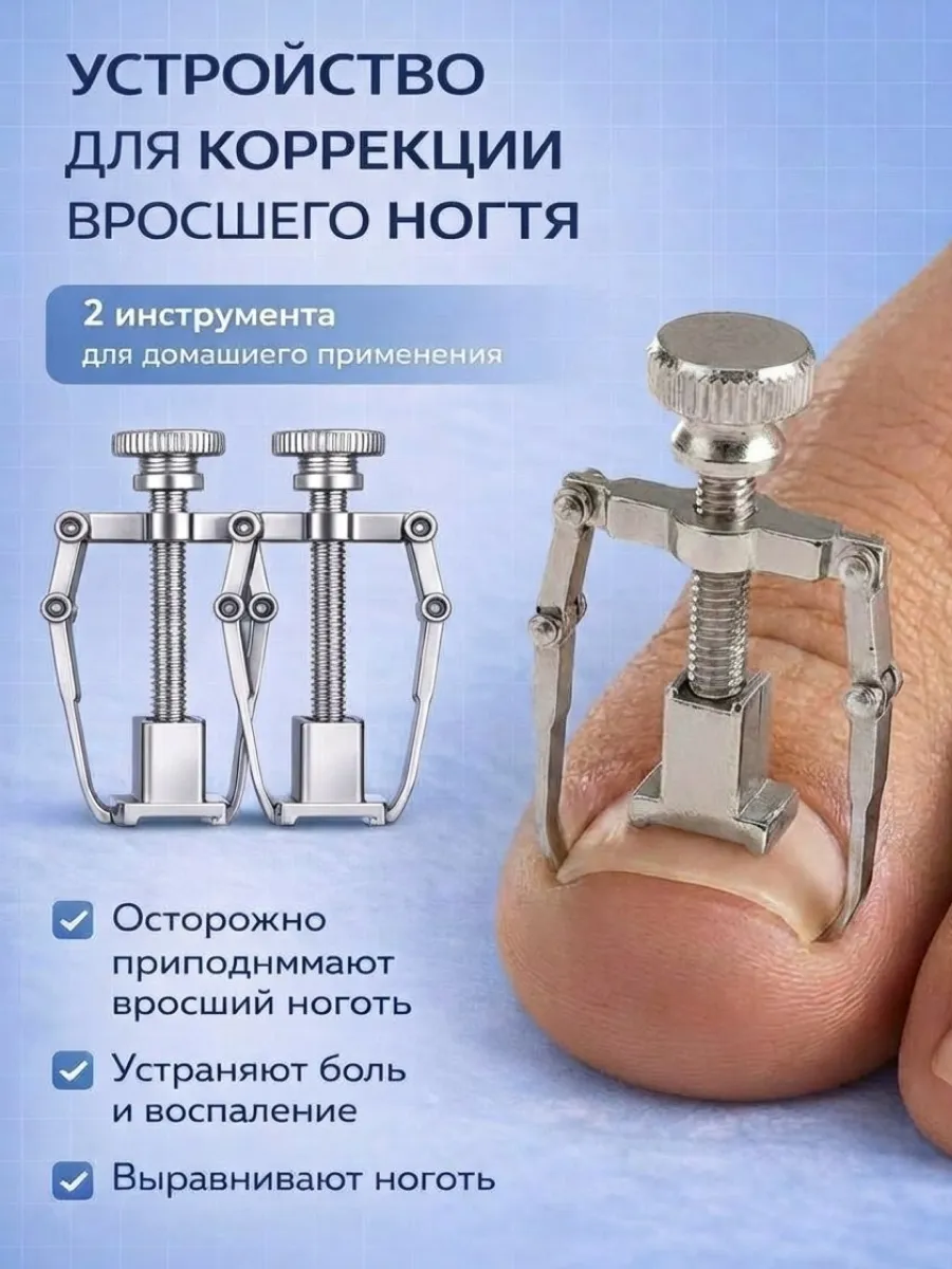 Корректор для вросшего ногтя на ногах