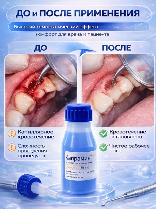 Наз01 Капрамин - кровоостанавливающее средство для маникюра, вариант, фото 6