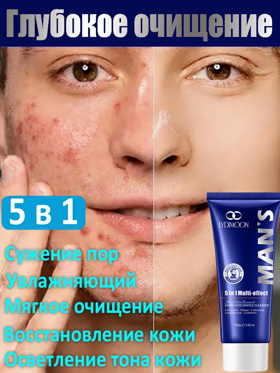 Средство для умывания лица мужской,очищение от жира и прыщей