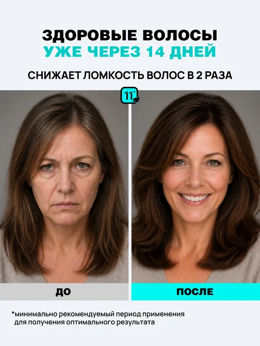 11i professional Кондиционер против выпадения волос с аминексилом, вариант, фото 2