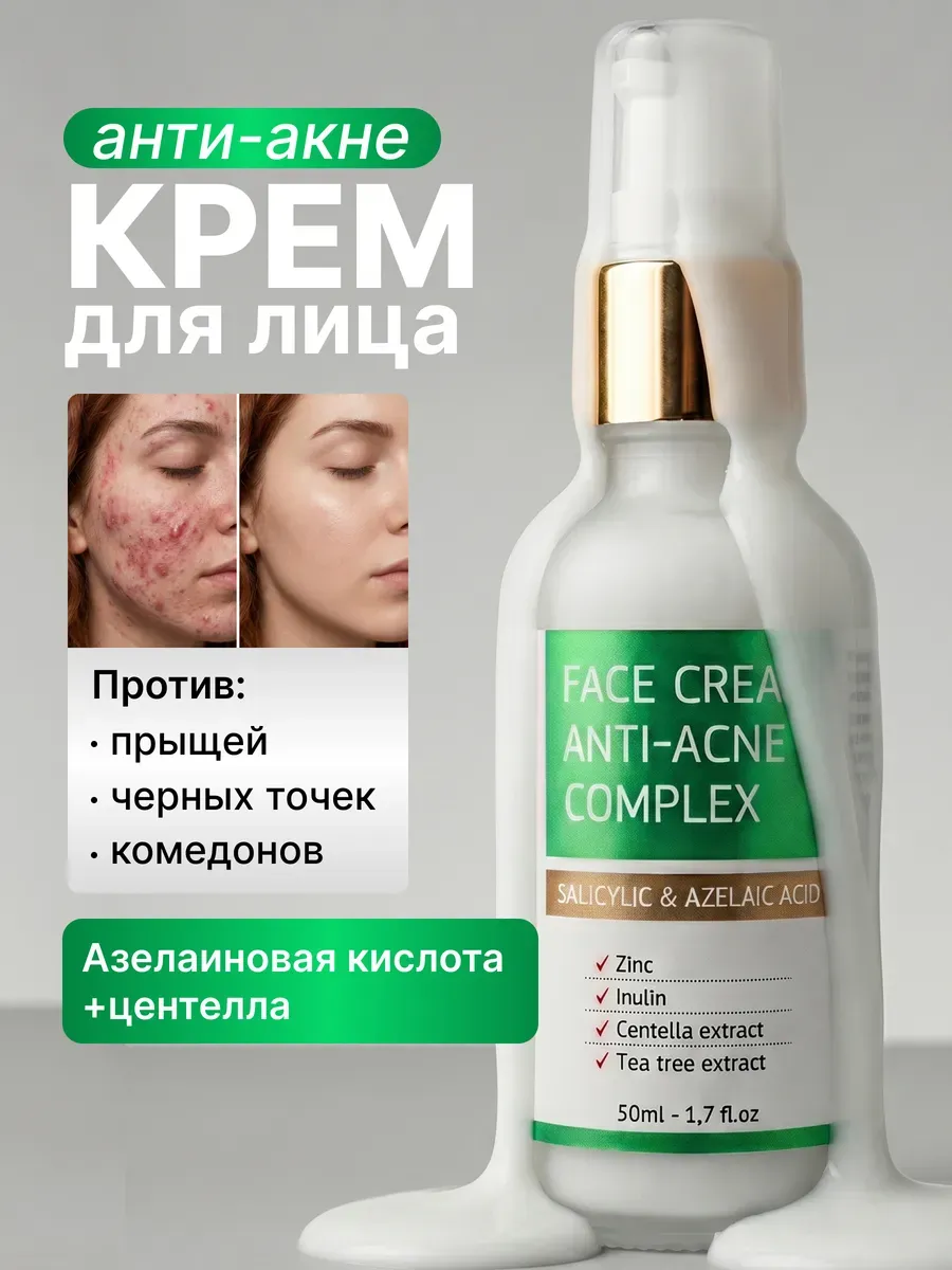 Крем для лица от прыщей с салициловой кислотой