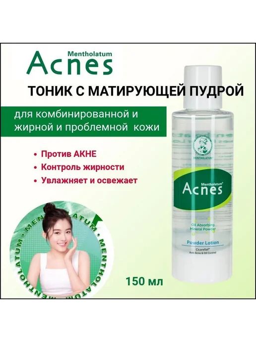 Матирующий лосьон от акне MENTHOLATUM ACNES 150мл, 150 мл, фото 2