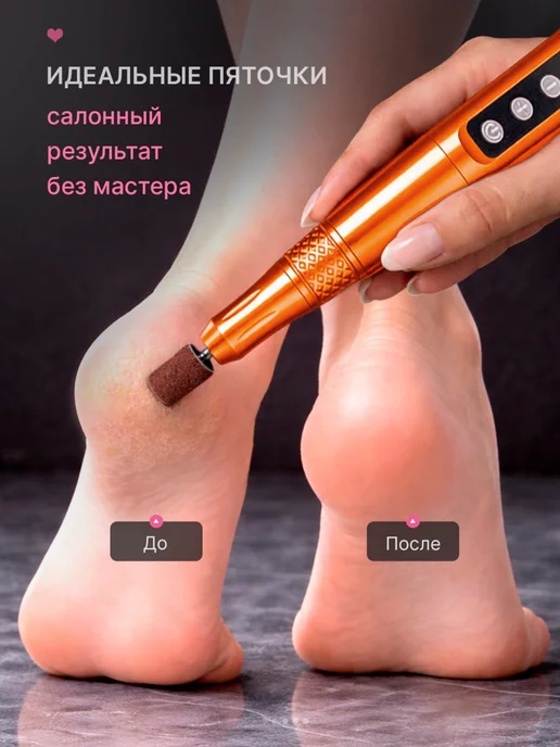 SKINTOUCH Аппарат для маникюра и педикюра домашний мощный с фрезами, оранжевый, фото 6