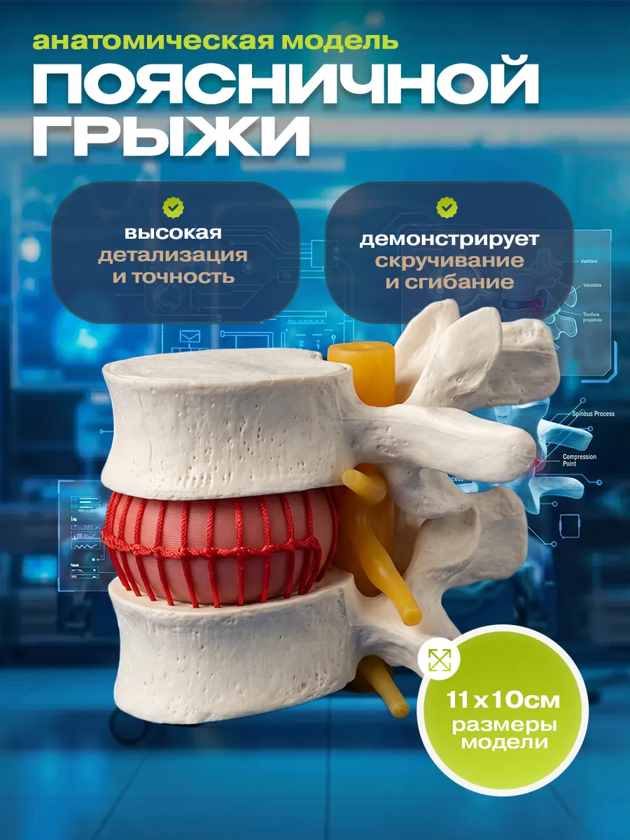 Медицинский макет грыжи поясничного отдела