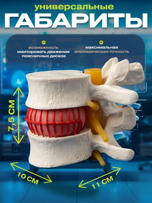 Anatomical Медицинский макет грыжи поясничного отдела, вариант, фото 2