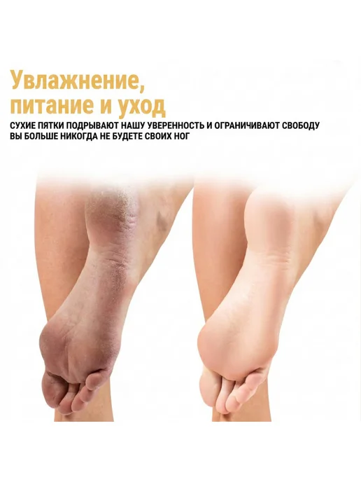 viareline. Спрей кератолитик для пяток c салициловая кислота от мозолей, 200 мл, фото 6