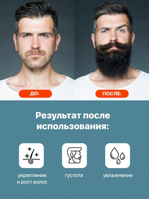 Подарочный набор для бороды REVOLUT мезороллер + масло, вариант, фото 5