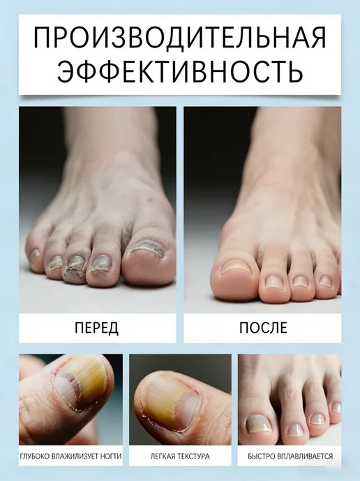 Ручка для ухода за ногтями, 12 мл, фото 7