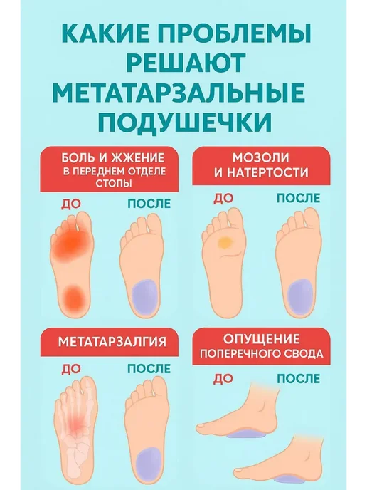 АЭА94 Гелевые стельки, 2 шт, фото 5