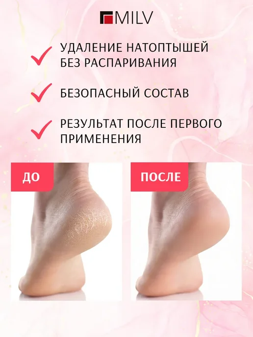 Жидкое лезвие кератолитик и терка для пяток профессиональная, 250 мл, фото 3